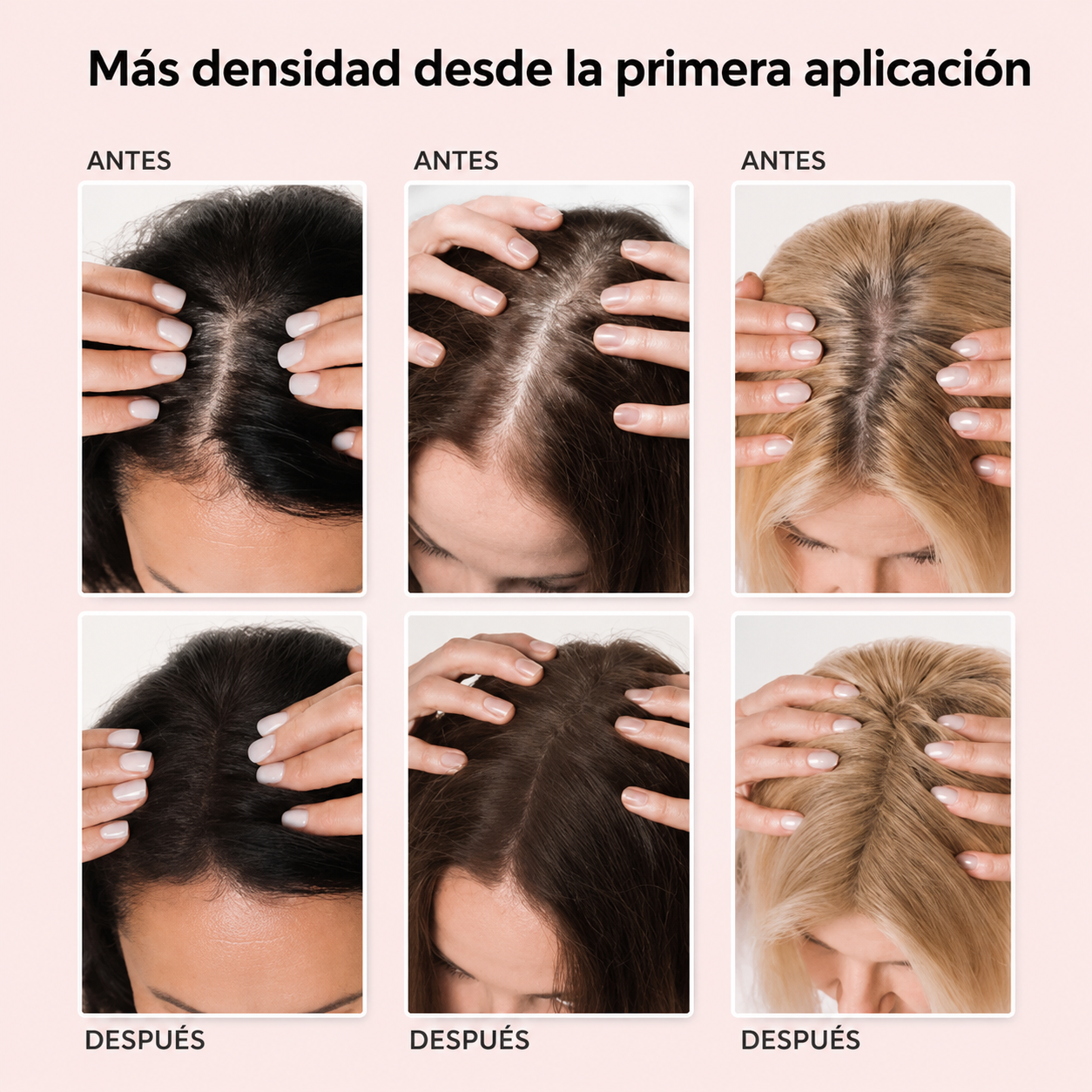 HairMagic Densificador Capilar