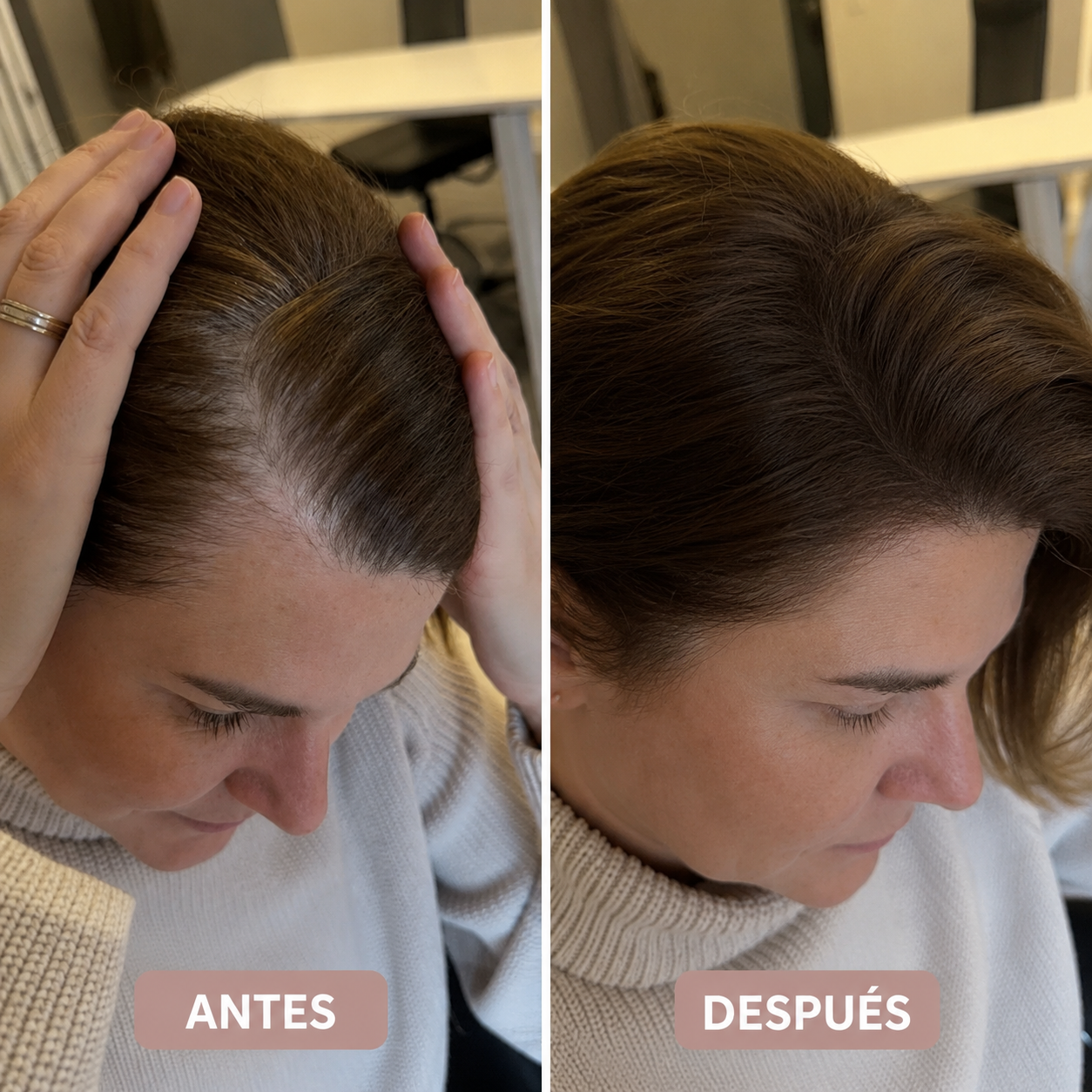 HairMagic Densificador Capilar