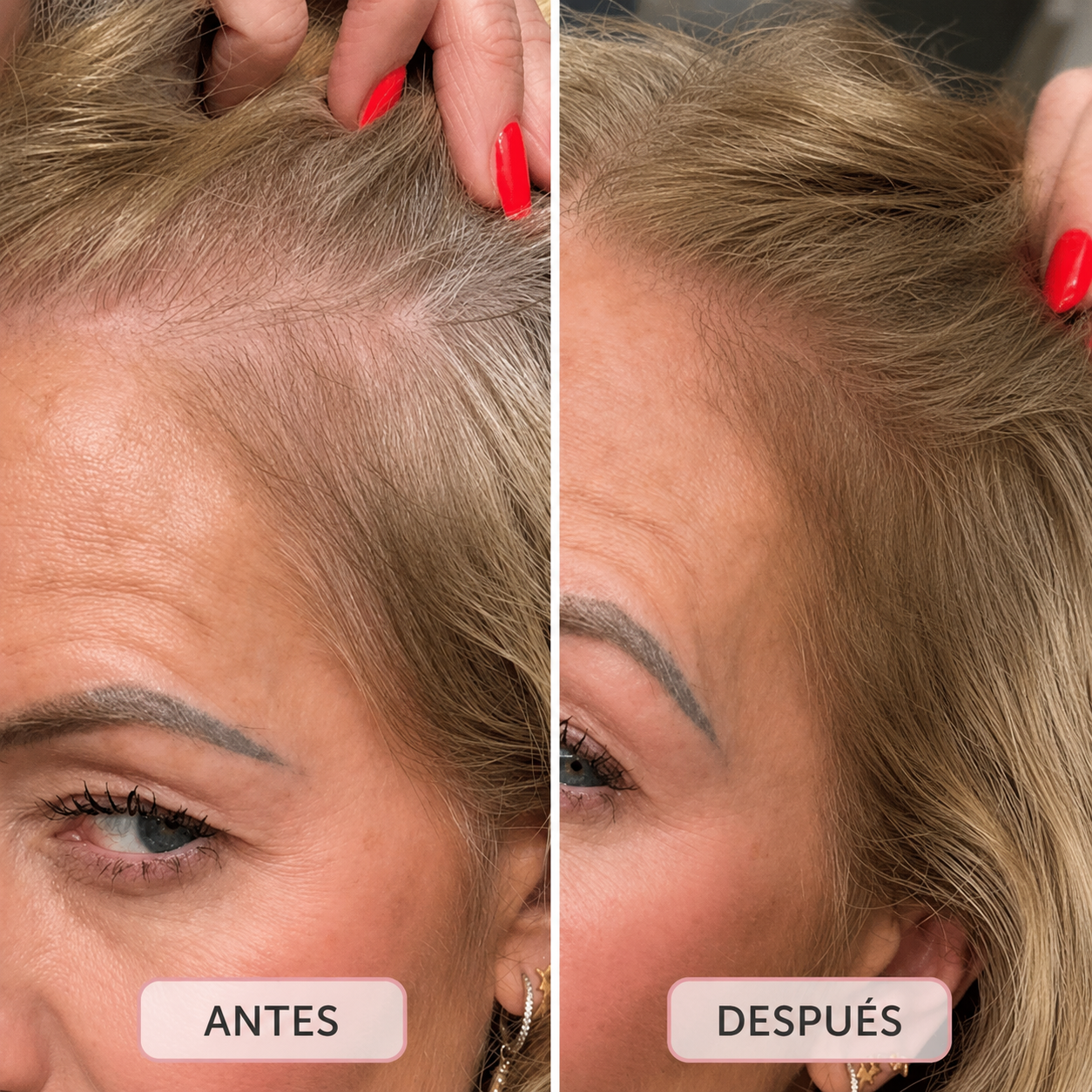 HairMagic Densificador Capilar